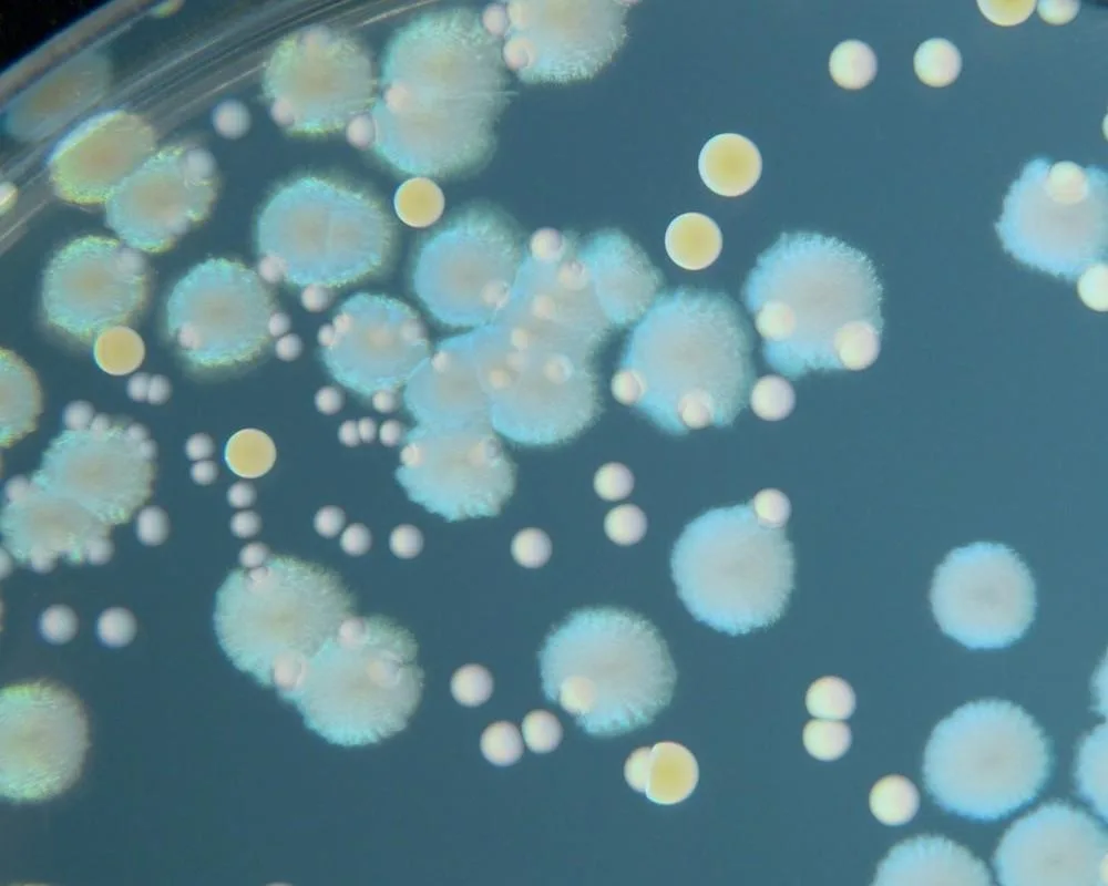 Kolonie bakterii Enterococcus na płytce agarowej